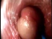 Video from the inside of a vagina... very interesting